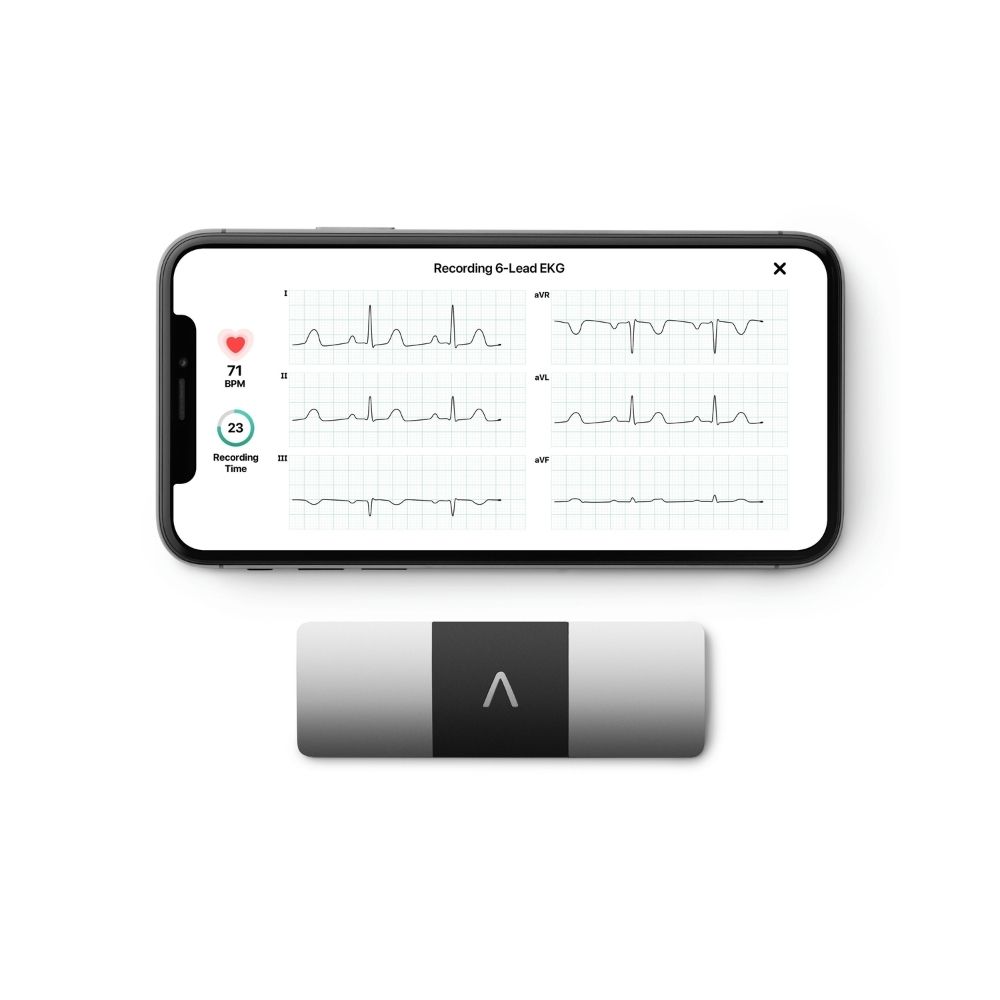 AliveCor KardiaMobile 6L