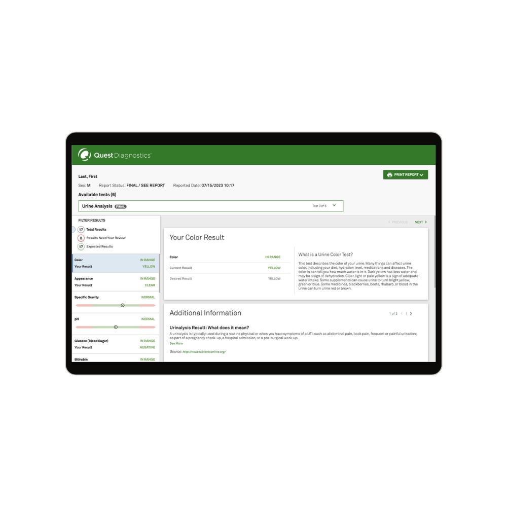 Quest Diagnostics (QuestHealth) Urinalysis/UTI Test